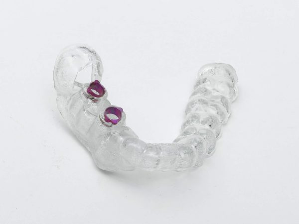 生物兼容的MED610牙科部件