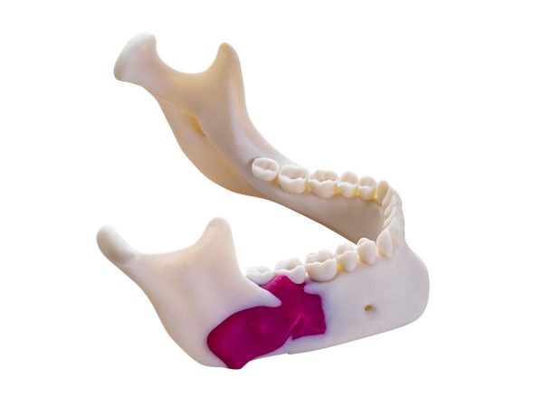 MediJet颌骨模型